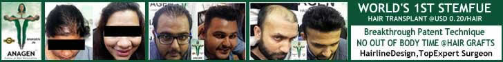 free hair transplant consultation