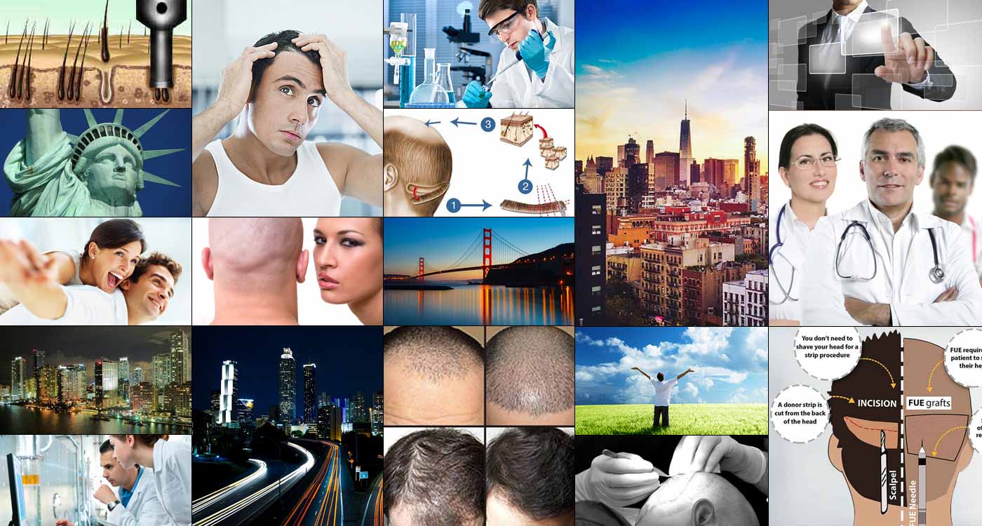 hair transplant photo gallery