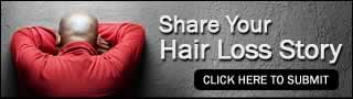 Share Hair Loss Story