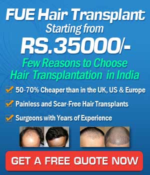 Hair Transplant in India - Free Quote
